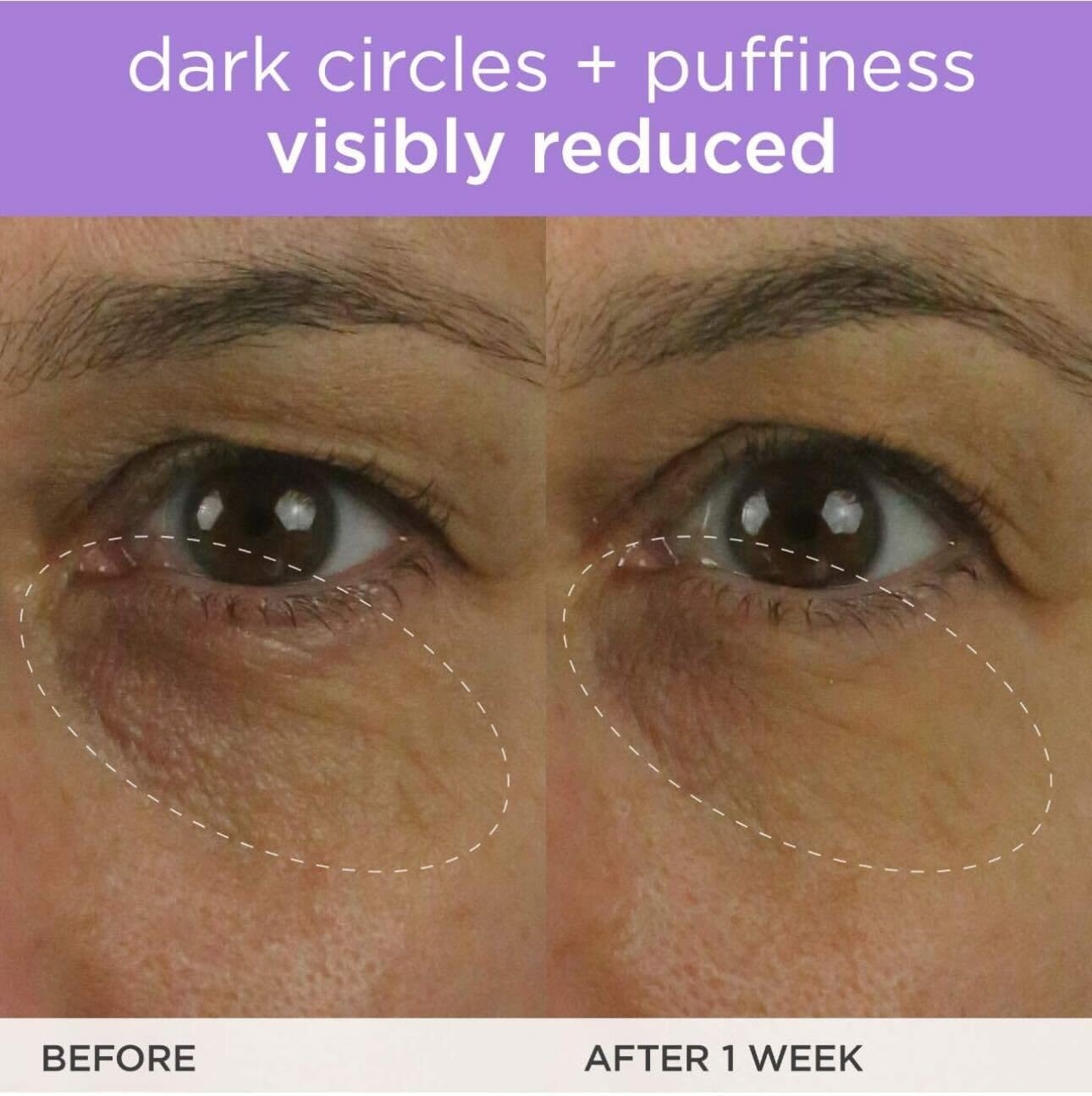 image:imageTATCHA The Brightening Eye Cream Brightening amp Dark Circle Reduction with Vitamin C for Bight Firm Undereyes 15 ml 05 fl oz