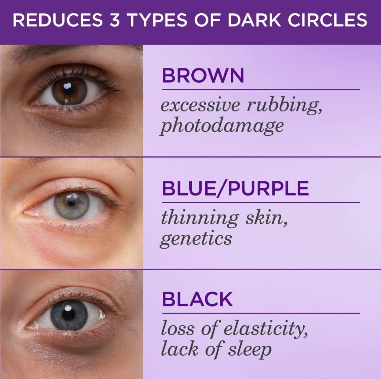 image:imageTATCHA The Brightening Eye Cream Brightening amp Dark Circle Reduction with Vitamin C for Bight Firm Undereyes 15 ml 05 fl oz