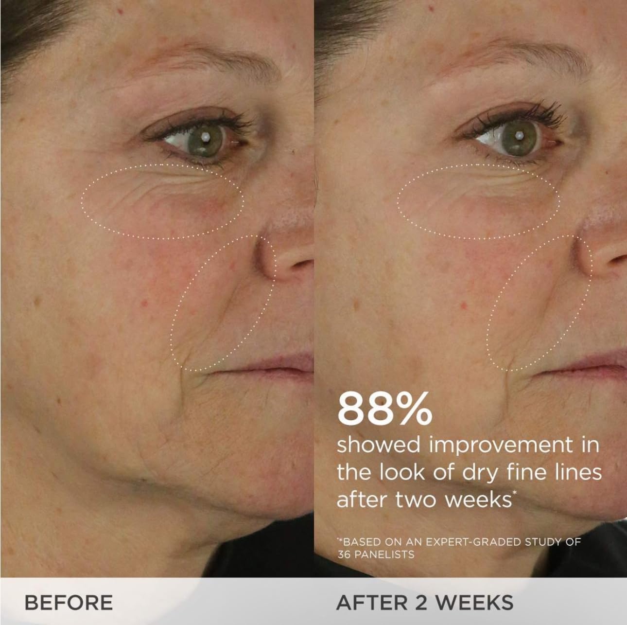 image:imageTATCHA The Dewy Skin Cream Rich LinePlumping Face Moisturizer Helps Replenish Ceramides and Intensely Hydrate Dry amp Combo Skin with Japanese Purple Rice Hyaluronic Acid amp Hadasei315 ml
