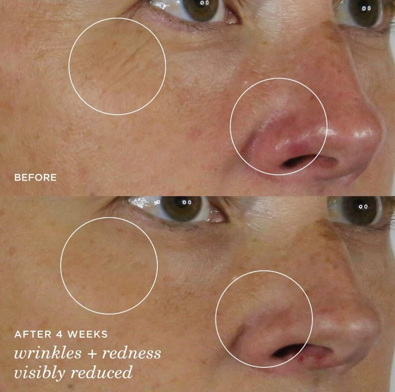image:imageTatcha The Silk Serum WrinkleSmoothing Retinol Alternative 30 ml 1 oz